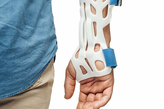 The right hand of a white male wearing a denim shirt with white 3d printed orthotics held together with BASF blue Velcro straps.